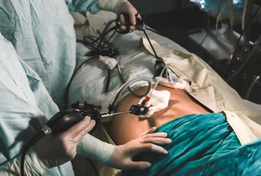 laparoscopic surgery on the Gold Coast